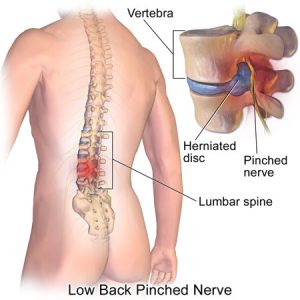 Bowen Therapy For Back Pain – Bowen and Natural Therapies
